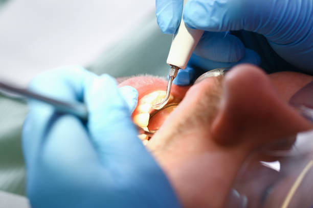 Professional Emergency Dental Service in OH
